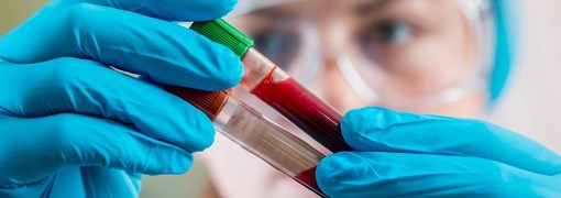 בדיקת EBV Antibodies - תמונה